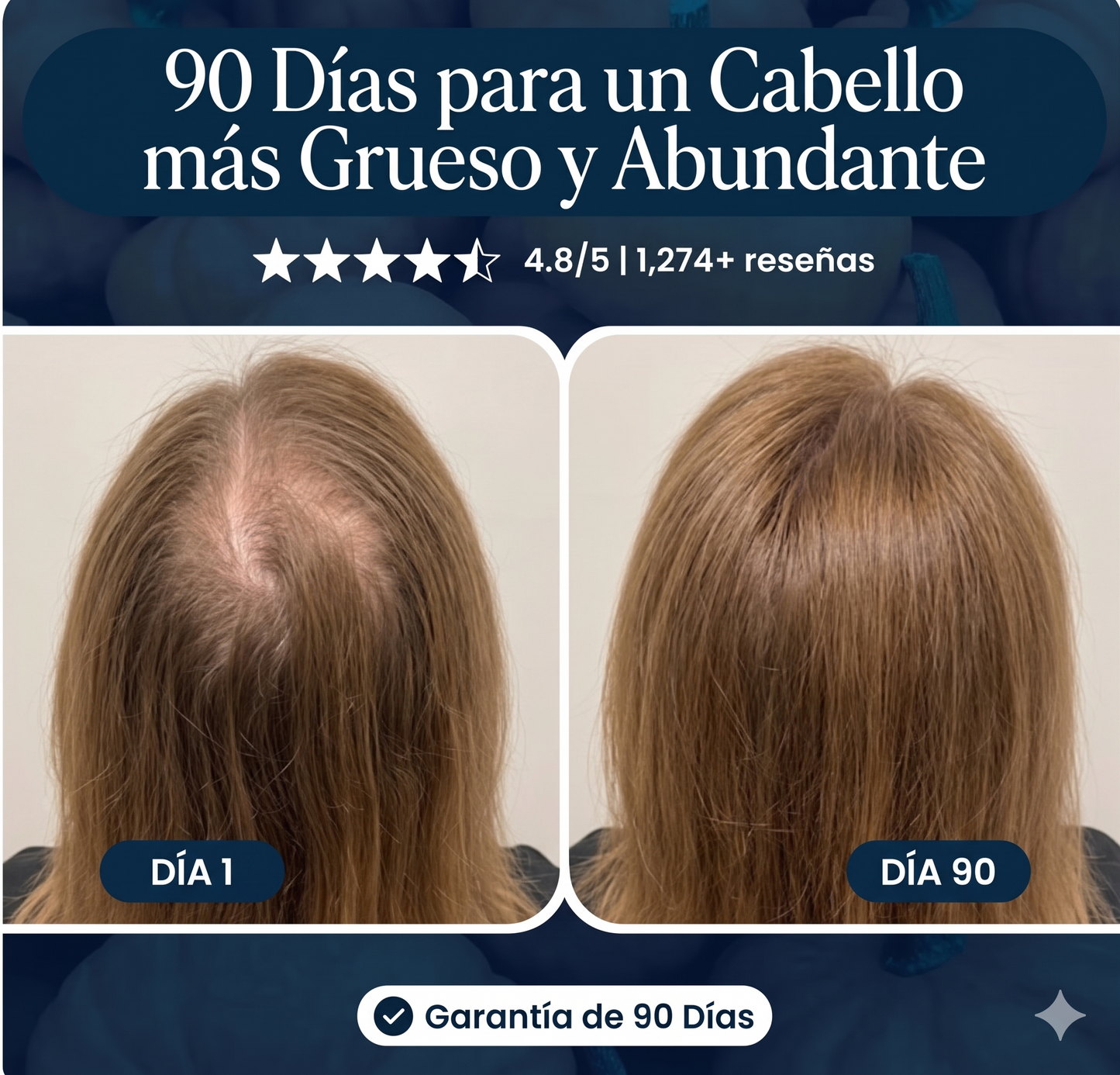 Crece Tu Cabello Naturalmente De Nuevo O Te Regresamos Tu Dinero