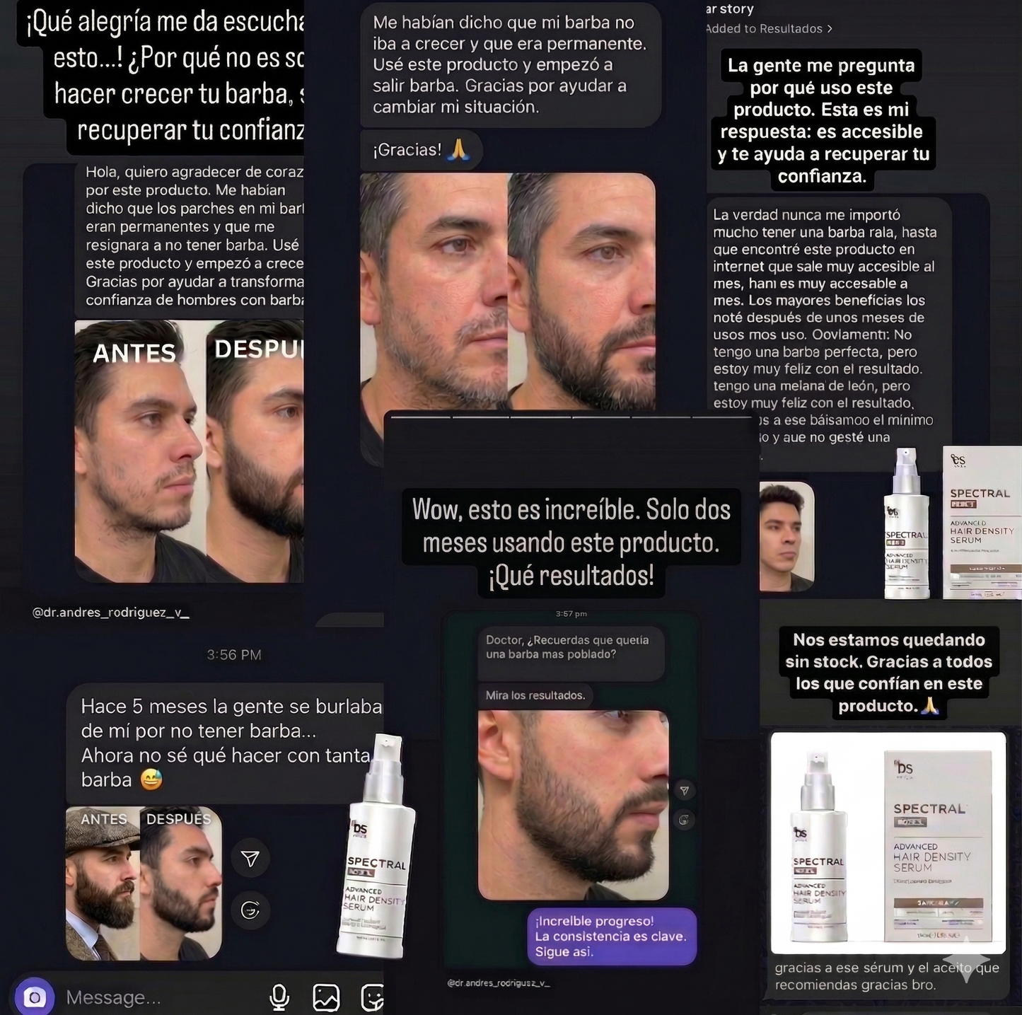 Haz crecer tu barba naturalmente de nuevo o te regresamos tu dinero