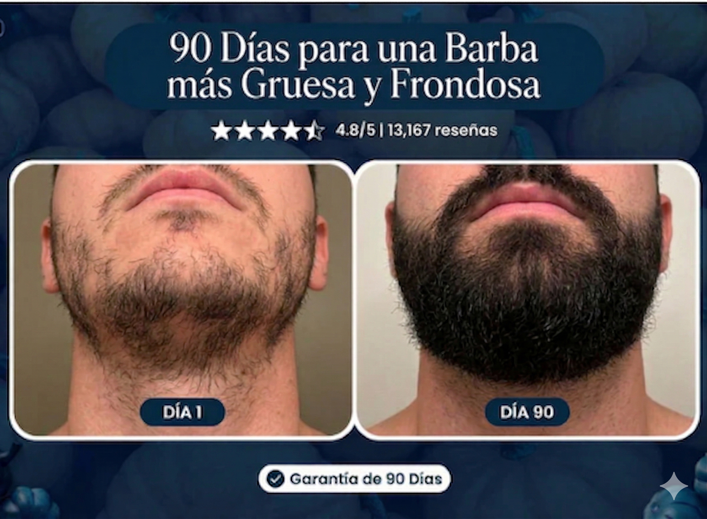 Haz crecer tu barba naturalmente de nuevo o te regresamos tu dinero
