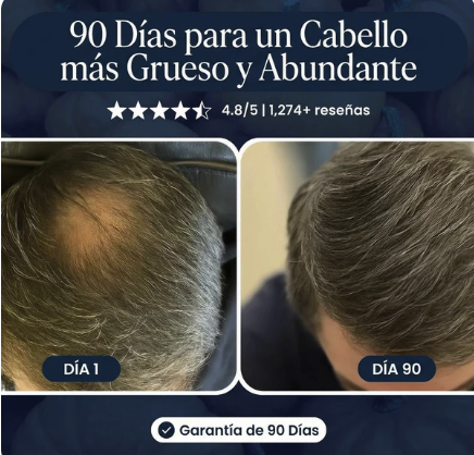 Crece Tu Cabello Naturalmente De Nuevo O Te Regresamos Tu Dinero