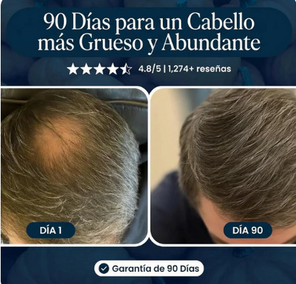Crece Tu Cabello Naturalmente De Nuevo O Te Regresamos Tu Dinero